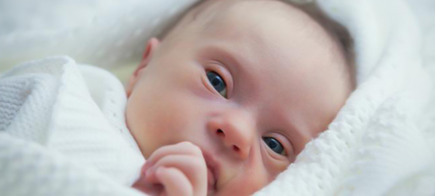 sindrom-down-bayi