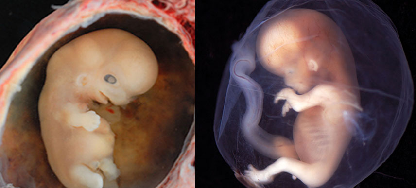 fetus.jpg