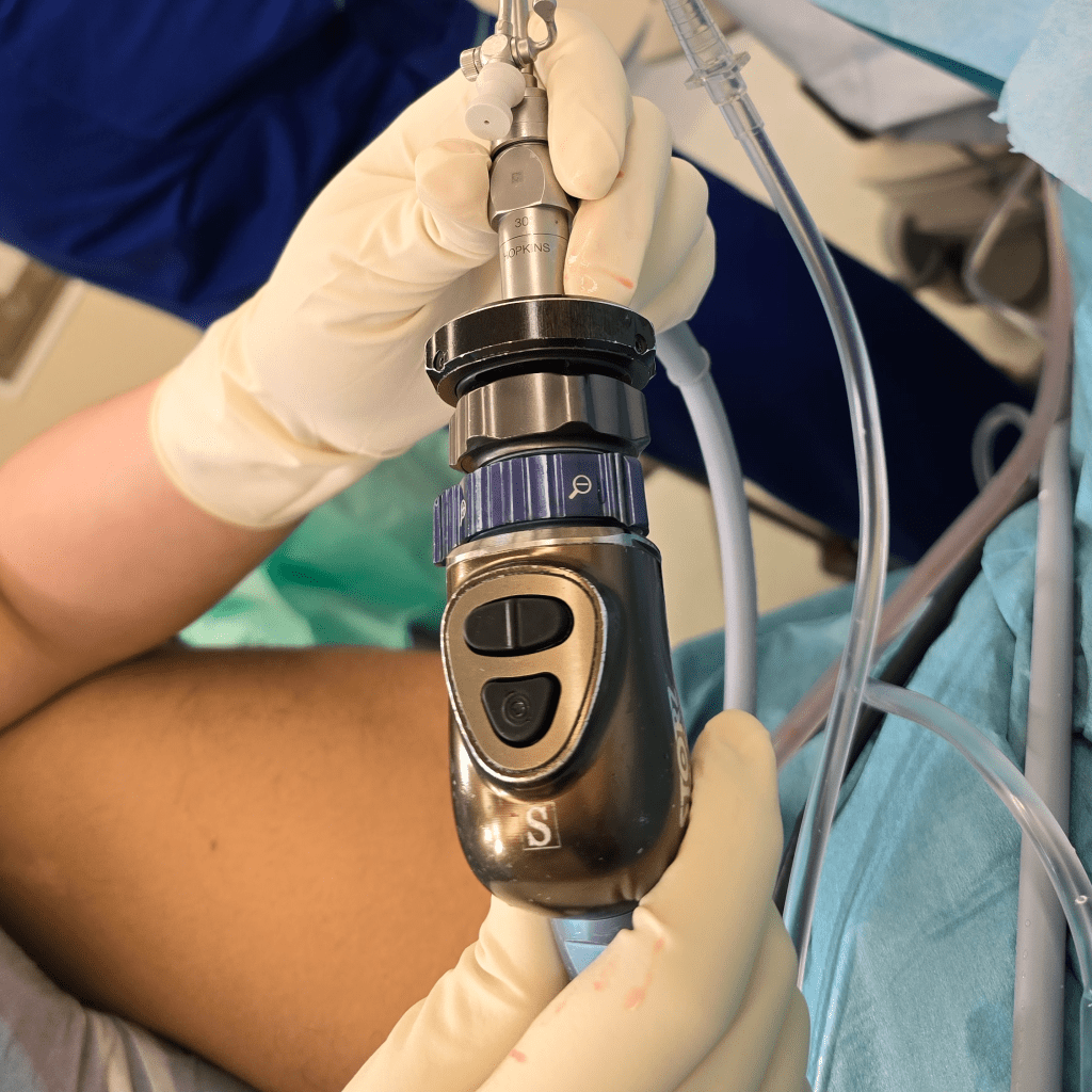 Apa itu Hysteroscopy?